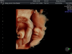 Pregnancy Scan 4D Scan Package