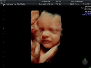 Pregnancy Scan 4D Scan Package