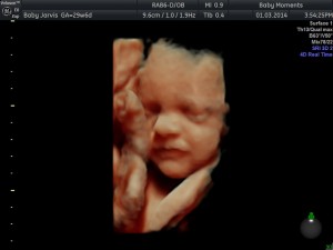 Pregnancy Scan 4D Scan Package Pregnancy Scan 4D Scan Package