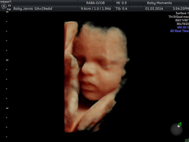 Baby scan 4d 4
