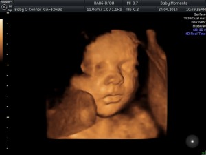 Pregnancy Scan 4D Scan Package