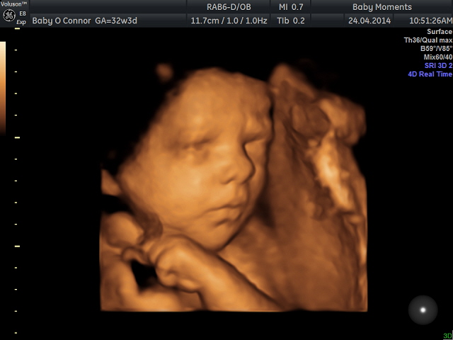 Baby scan berkshire