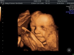 Pregnancy Scan 4D Scan Package