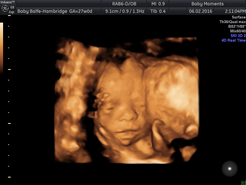 Best Ever 4d Scan Baby Images pixaby